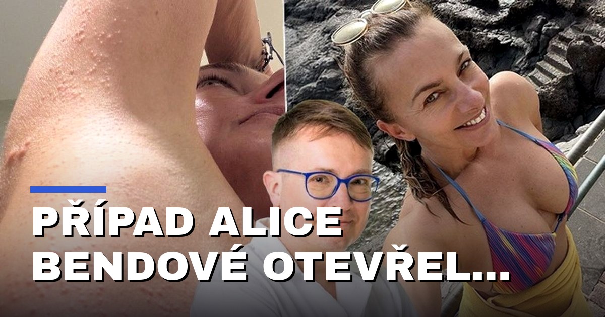 Případ Alice Bendové otevřel debatu o reklamě na kosmetiku a vlivu algoritmů